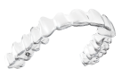Unsichbare Zahnspange mit Invisalign